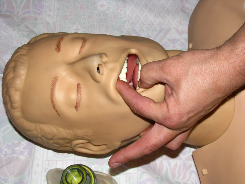Pravilno odpiranje ust pred vstavitvijo tubusa
