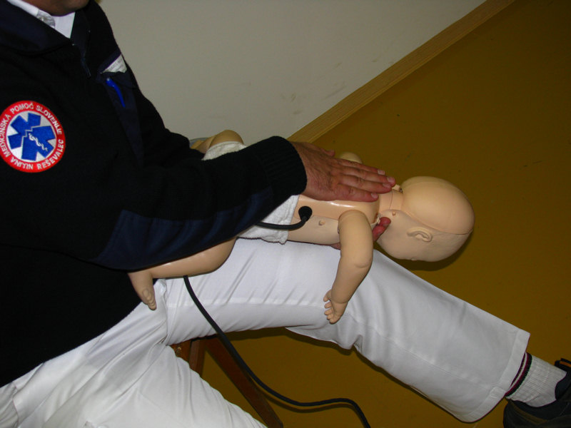 Dušitve, namestitev dojenčka na iztegnjeno nogo navzdol ter udarci po hrbtu
